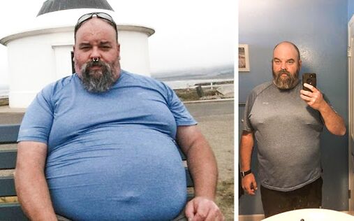 Photo before and after the Keto probiotix course, the experience of using capsules with a Migter from Venice